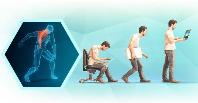 slaba drža pri delu za računalnikom in torakalna osteohondroza