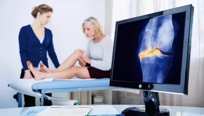 Arthroza sklepa pri ženski